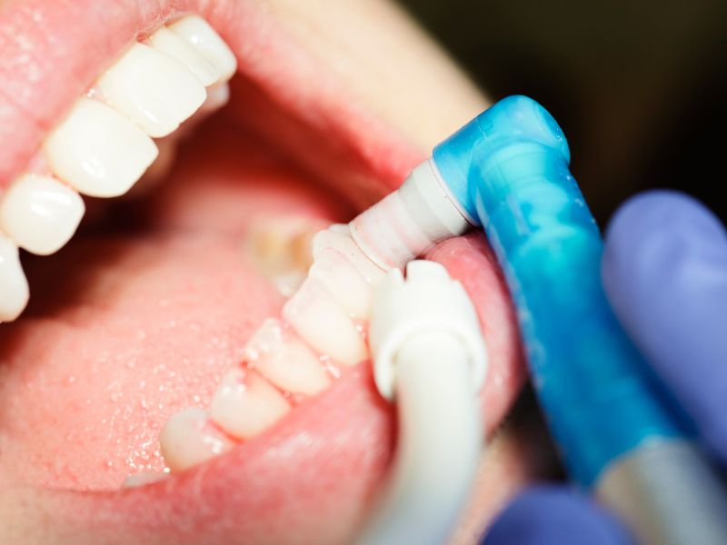 diseño de sonrisa en fusagasuga