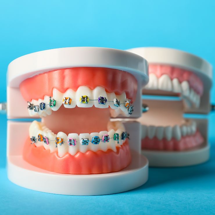 ortodoncia en fusagasuga