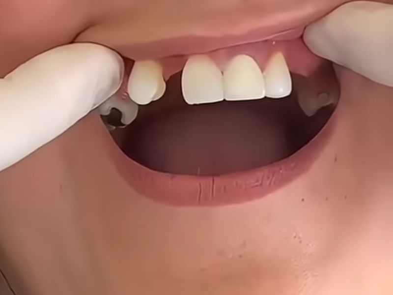 rehabilitacion oral en fusagasuga