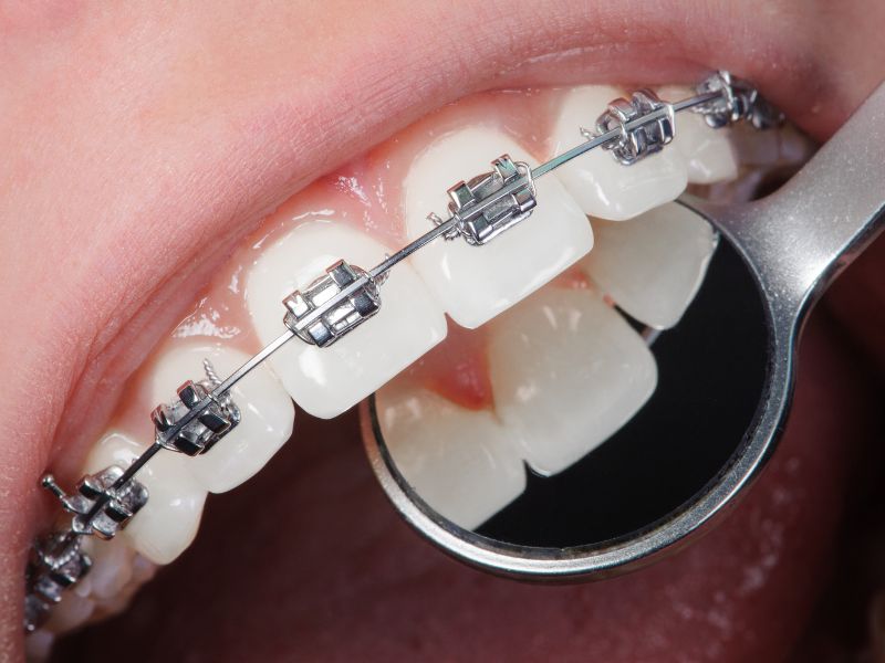 servicio de ortodoncia en fusacatan