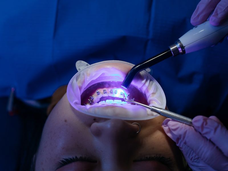 servicio de ortodoncia en fusagasuga