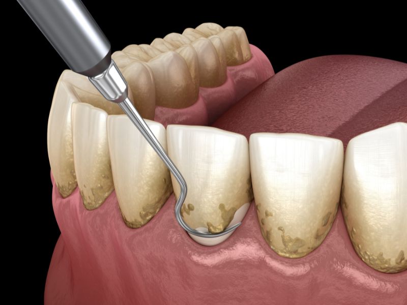 servicio de periodoncia